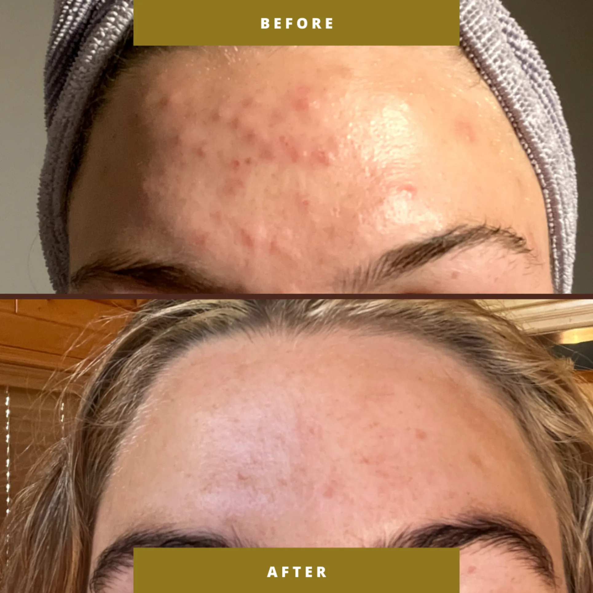 Aesthetic Treatments Park City